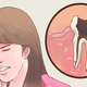 Imagen: Dental Pain Relief. Dr Nepal - YouTube.